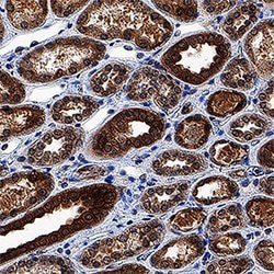 Human/Mouse/Rat MST2/STK3 Antibody, R D Systems:Antibodies:Primary Antibodies