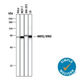 Human/Mouse/Rat MST2/STK3 Antibody, R D Systems:Antibodies:Primary Antibodies
