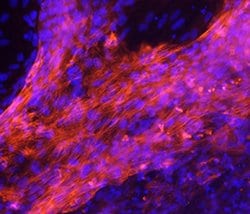Human MYH7 Antibody, R D Systems 25&mu;g; Unlabeled:Antibodies, Monoclonal