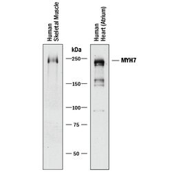 Human MYH7 Antibody, R D Systems:Antibodies:Primary Antibodies