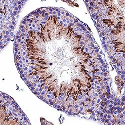 Mouse Mer Antibody, R D Systems 100 &mu;g | Buy Online | R&D Systems | Fisher Scientific