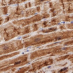 Human Myoglobin Antibody, R D Systems:Antibodies:Primary Antibodies