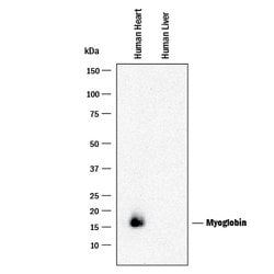 Human Myoglobin Antibody, R D Systems:Antibodies:Primary Antibodies