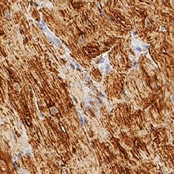 Human/Mouse/Rat Myoglobin Antibody, R D Systems:Antibodies:Primary Antibodies