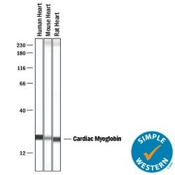 Human/Mouse/Rat Myoglobin Antibody, R D Systems:Antibodies:Primary Antibodies