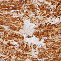 Human Myoglobin Antibody, R D Systems:Antibodies:Primary Antibodies