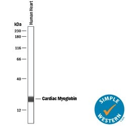 Human Myoglobin Antibody, R D Systems:Antibodies:Primary Antibodies