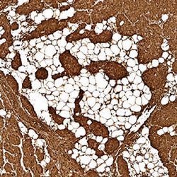 Human/Rat Myoglobin Antibody, R D Systems 100&mu;g:Antibodies, Monoclonal