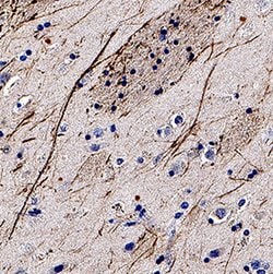 Human NF-H Antibody, R D Systems 100 &mu;g | Buy Online | R&D Systems | Fisher Scientific