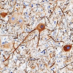 Human/Mouse/Rat NF-L Antibody, R D Systems 100&mu;g:Antibodies, Monoclonal