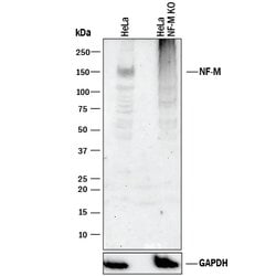 Human NF-M Antibody, R D Systems 25&mu;g; Unlabeled:Antibodies, Polyclonal