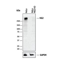 Human NG2/MCSP Antibody, R D Systems 100μg; Unlabeled:Antibodies, Polyclonal