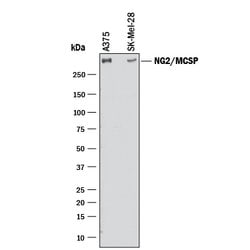 Human NG2/MCSP Antibody, R D Systems 100ug; Unlabeled:Antibodies, Monoclonal