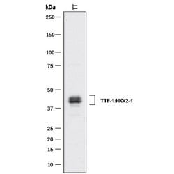 Human TTF-1/NKX2-1 Antibody, R D Systems 100&mu;g:Antibodies, Monoclonal