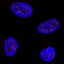 Human TTF-1/NKX2-1 Antibody, R D Systems 100ug; Unlabeled:Antibodies, Monoclonal