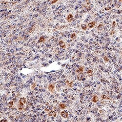 Human NKp46/NCR1 Antibody, R D Systems 25&mu;g; Unlabeled:Antibodies, Polyclonal
