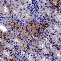Human NLRP1/NALP1 Antibody, R D Systems 100 &mu;g; Unconjugated:Antibodies,