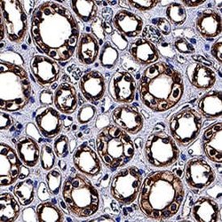 Human NPRA/NPR1 Antibody, R D Systems:Antibodies:Primary Antibodies