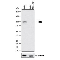 Human Nbs1 Antibody, R D Systems 100&mu;g; Unlabeled:Antibodies, Polyclonal
