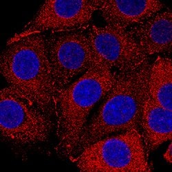 Human Nectin-2/CD112 Antibody, R D Systems 100 &mu;g; Unconjugated:Antibodies,