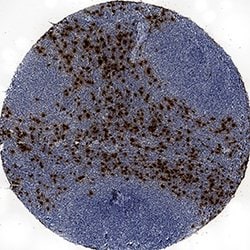 Human Neutrophil Elastase/ELA2 Antibody, R D Systems:Antibodies:Primary