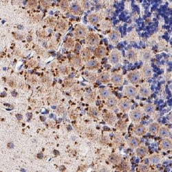 Human/Mouse/Rat Niemann-Pick Type C1/NPC1 Antibody, R D Systems 100 &mu;g | Buy Online | R&D Systems | Fisher Scientific