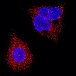 Human ORM2 Antibody (Clone 959445), R D Systems:Antibodies:Primary Antibodies