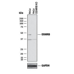 Human OSMR beta Antibody, R D Systems 100ug; Unlabeled:Antibodies, Monoclonal
