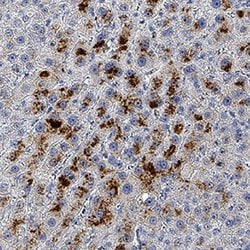 Human Ornithine Carbamoyltransferase/OTC Antibody, R D Systems 100 &mu;g;