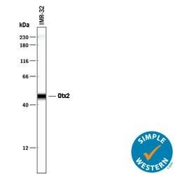 Human Otx2 Antibody, R D Systems 100&mu;g; Unlabeled:Antibodies, Polyclonal