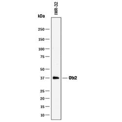 Human Otx2 Antibody, R D Systems 100&mu;g; Unlabeled:Antibodies, Polyclonal