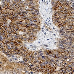 Human PAR1 Antibody, R D Systems 100ug; Unlabeled:Antibodies, Monoclonal