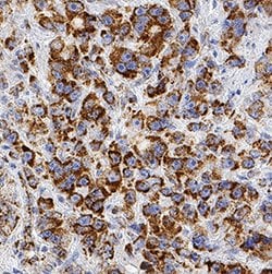 Human/Mouse PBR Antibody, R D Systems 25 &mu;g; Unconjgated:Antibodies,