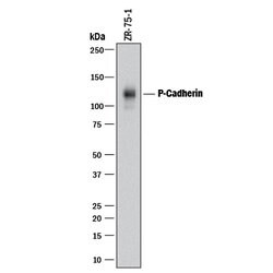Human P-Cadherin Antibody, R D Systems 100&mu;g:Antibodies, Monoclonal