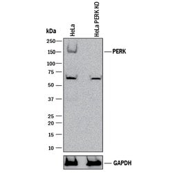 Human PERK Antibody, R D Systems 25&mu;g; Unlabeled:Antibodies, Polyclonal