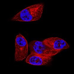Human/Mouse PKA RII alpha Antibody, R D Systems:Antibodies:Primary Antibodies