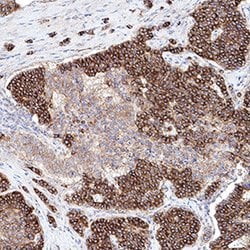 Human/Mouse PKA RII alpha Antibody, R D Systems:Antibodies:Primary Antibodies
