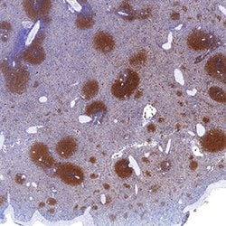 Human/Mouse PKC beta 2 Antibody, R D Systems 100ug; Unlabeled:Antibodies,