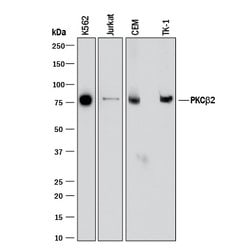 Human/Mouse PKC beta 2 Antibody, R D Systems 100ug; Unlabeled:Antibodies,