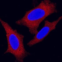 Human PKM1/2 Antibody, R D Systems 25 &mu;g; Unconjugated:Antibodies, Monoclonal