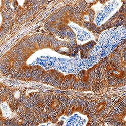 Human/Mouse PLA2G4A Antibody, R D Systems 25&mu;g; Unlabeled:Antibodies,