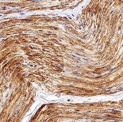 CGRP1 Antibody (2413G), Unconjugated, R D Systems:Antibodies:Primary Antibodies