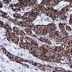 Human Procalcitonin Antibody, R D Systems 100&mu;g:Antibodies, Monoclonal