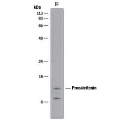 Human Procalcitonin Antibody, R D Systems 100&mu;g:Antibodies, Monoclonal