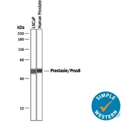 Human Prostasin/Prss8 Antibody, R D Systems 100 &mu;g | Buy Online | R&D Systems | Fisher Scientific