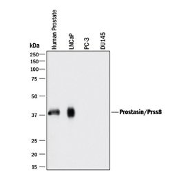 Human Prostasin/Prss8 Antibody, R D Systems 100 &mu;g | Buy Online | R&D Systems | Fisher Scientific