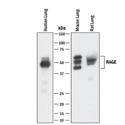 Human/Mouse/Rat RAGE/AGER Antibody, R D Systems 25&mu;g; Unlabeled:Antibodies,