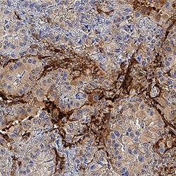Human RAGE Antibody, R D Systems 500 &mu;g | Buy Online | R&D Systems | Fisher Scientific