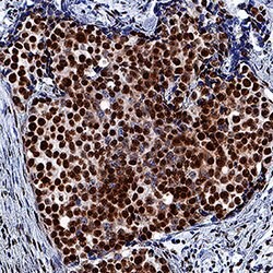 Human/Mouse/Rat RBBP4 Antibody, R D Systems:Antibodies:Primary Antibodies
