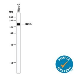 Human ROR1 Antibody, R D Systems 100&mu;g; Unlabeled:Antibodies, Polyclonal